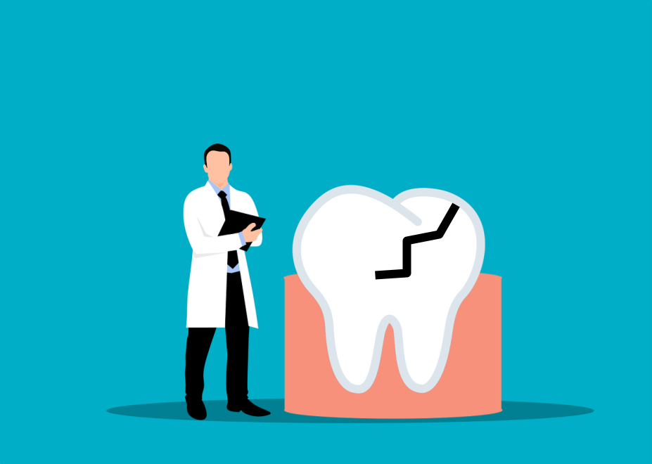 Cracked Tooth Image