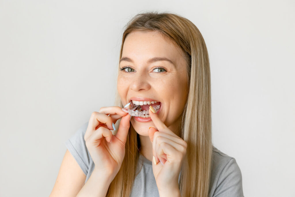 Orthodontics - Clear Aligners