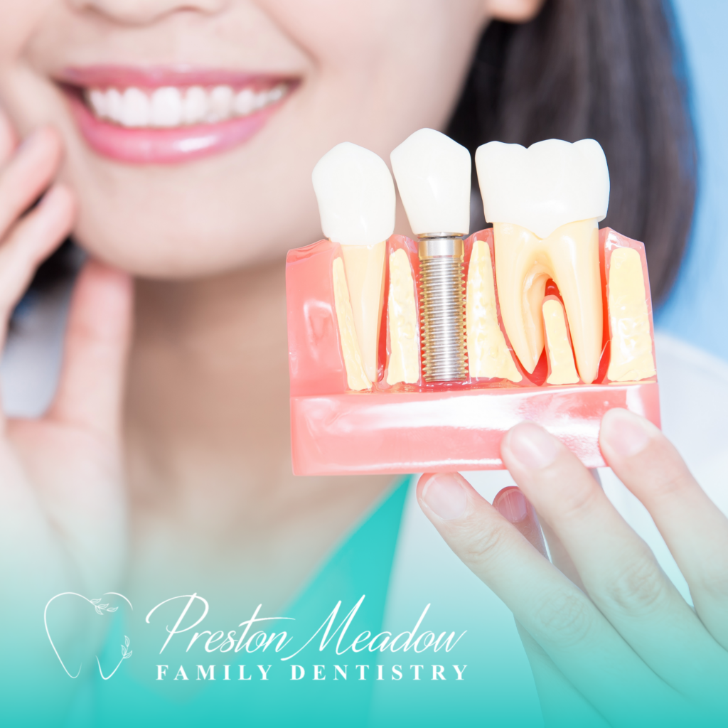 Plano dentist implants